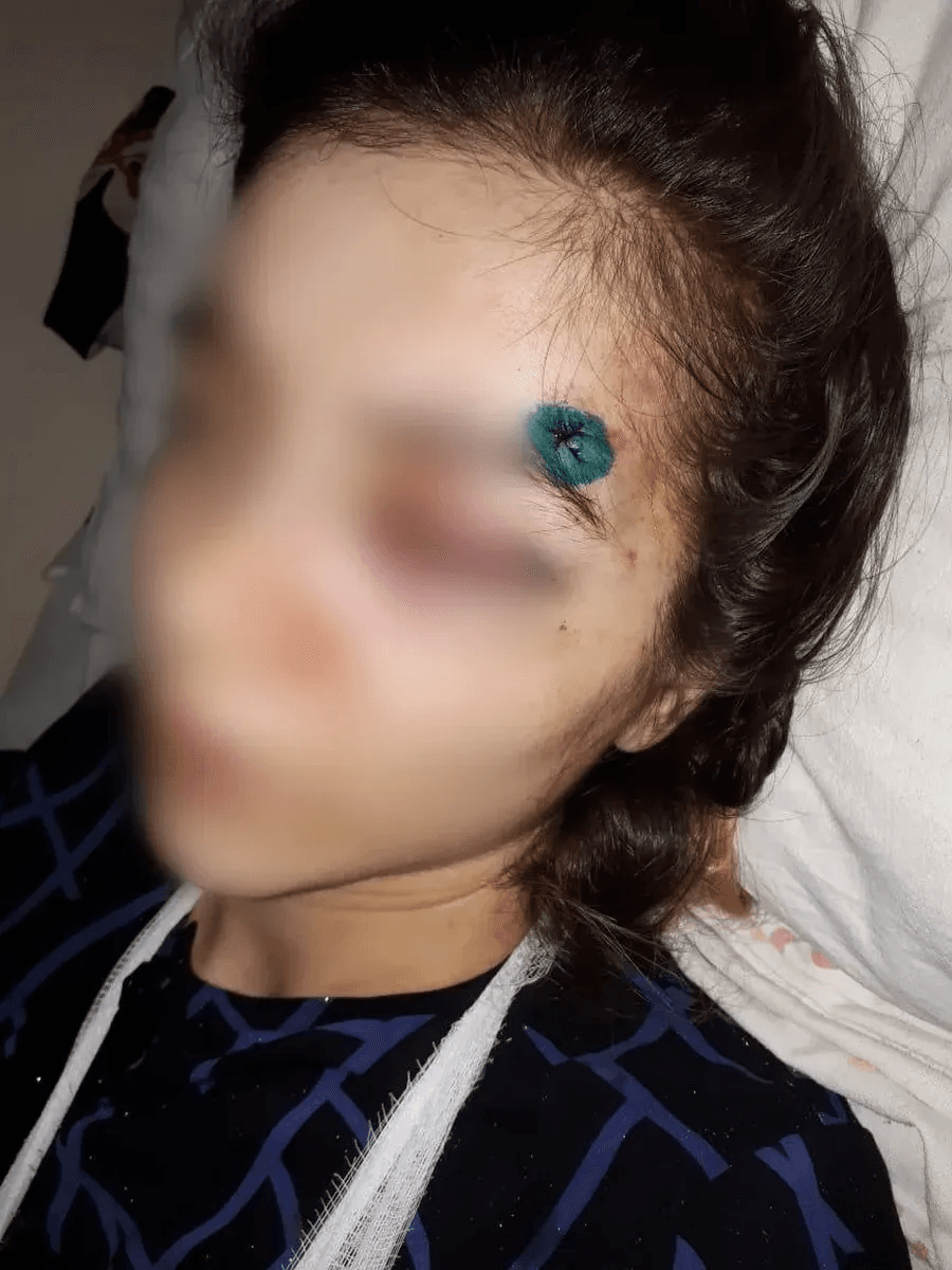 Пострадавшая от домашнего насилия дагестанка выиграла дело в ЕСПЧ