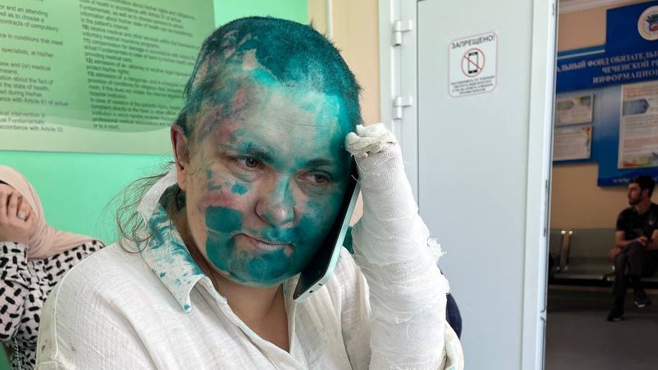 Жестокое нападение в Грозном — ответственность не только Кадырова, но и Путина